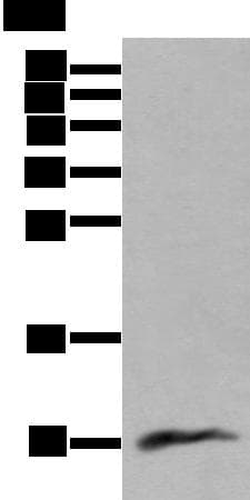 Polyclonal Rabbit anti-Human CCL18 / PARC Antibody (WB)