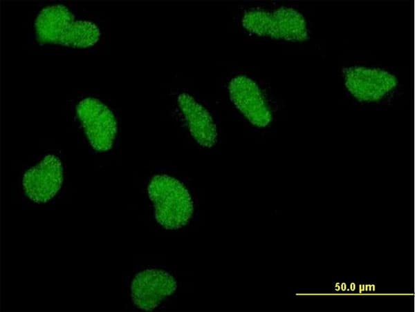 Monoclonal Mouse anti-Human MED1 / TRAP220 Antibody (clone 2A2, IF, WB)
