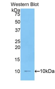 IL6R / IL6 Receptor Antibody (aa385-462)