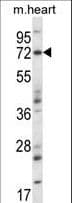 Polyclonal Rabbit anti-Mouse MAP3K7 / TAK1 Antibody (aa131-160, IHC, WB)