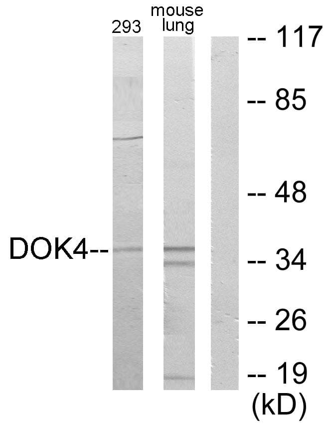 DOK4 Antibody