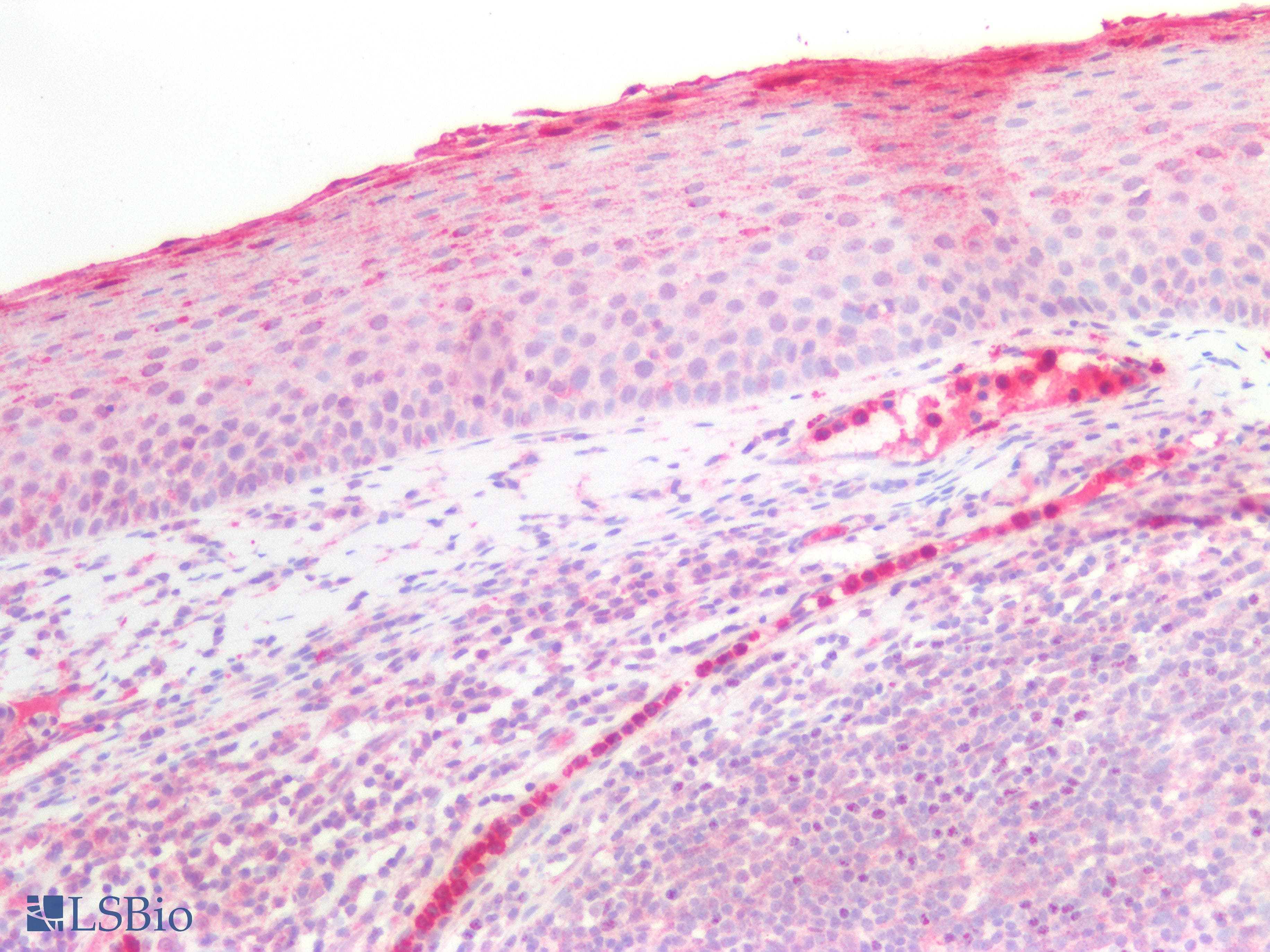 PathPlus™ Polyclonal Rabbit anti-Human LCN2 / Lipocalin 2 / NGAL Antibody (IHC, IF, WB)
