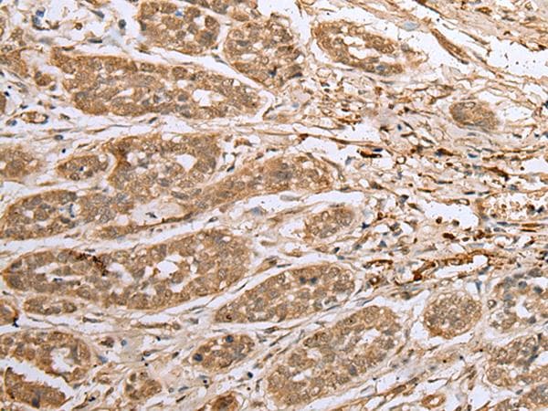 Polyclonal Rabbit anti-Human ATXN7L3 Antibody (IHC)