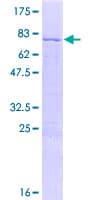 Human MRPS31 Protein (Recombinant GST)
