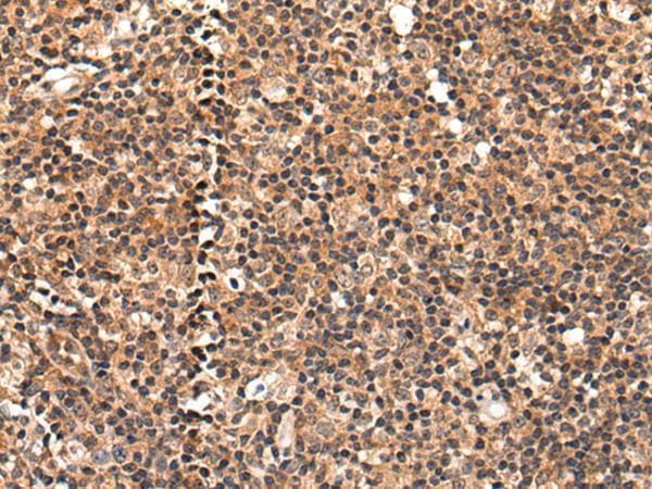 Polyclonal Rabbit anti-Human C16orf45 Antibody (IHC)