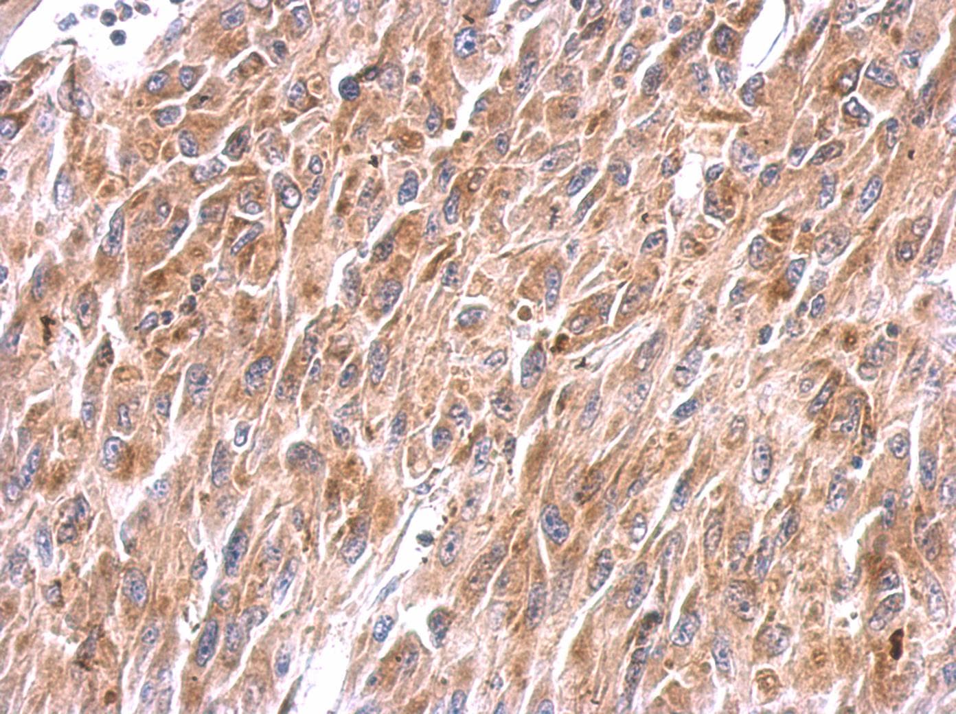 NDUFS8 Antibody (aa1-210)