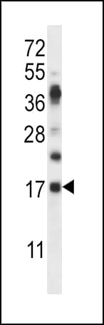 RNASE6 Antibody (aa119-147)