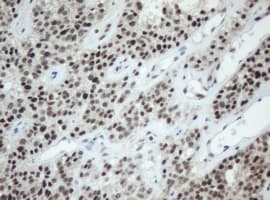 SF3A1 / SF3A120 Antibody (aa249-568, clone OTI3F4, Carrier-free)