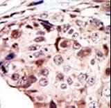 RYK Antibody (aa160-190)