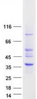 Human HSD17B11 Protein (Recombinant Myc-DDK (Flag))