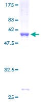 Human MED6 Protein (Recombinant GST)