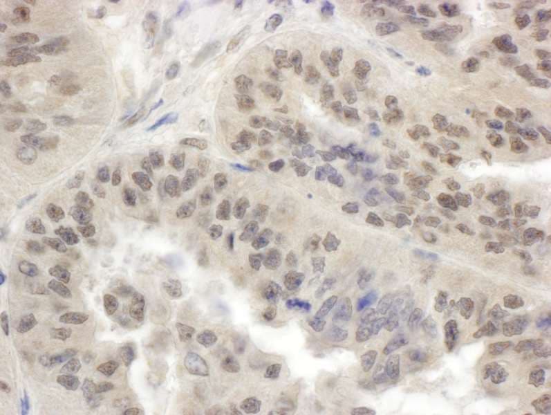 SMG1 / ATX Antibody (aa2925-2975)