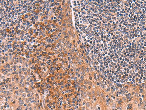 Polyclonal Rabbit anti-Human ACYP1 Antibody (IHC, WB)