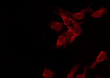 AKT1 Antibody (phospho-Ser473)