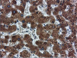 Monoclonal Mouse anti-Human FDFT1 / Squalene Synthase Antibody (clone OTI2F10, IHC, IF, WB)