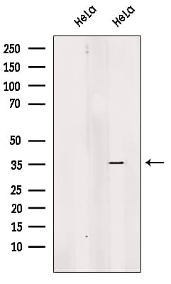 Polyclonal Rabbit anti-Human EXOSC8 Antibody (WB)
