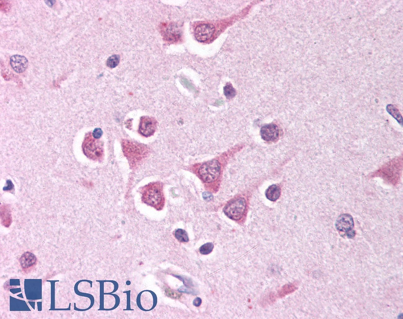 IHC-plus™ PPP4C Antibody (aa294-307)