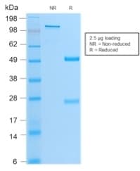 Recombinant Monoclonal Rabbit anti-Human MYOD / MYOD1 Antibody (clone MYOD1/2075R, IHC)