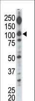DGK-IOTA / DGKI Antibody (aa890-920)