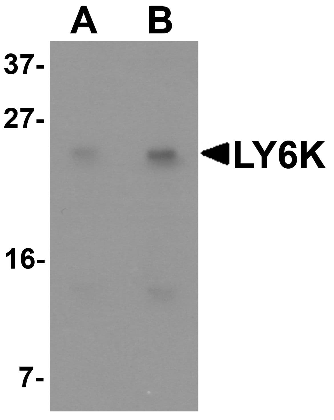 LY6K Antibody