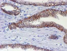 ERBB2 / HER2 Antibody (aa676-1255, clone OTI11A7, Carrier-free)