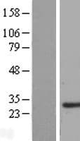 SMNDC1 Protein (Over-Expression Lysate Myc-DDK (Flag))