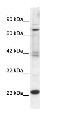 RGS10 Antibody (C-Terminus)