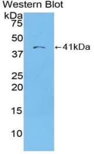 CCL22 / MDC Antibody (aa25-93)