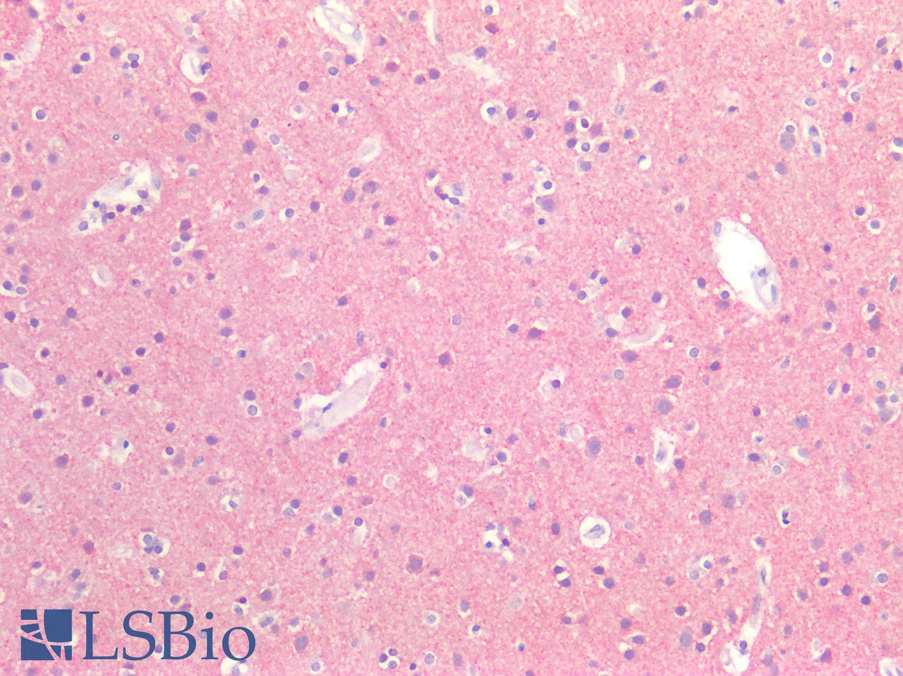 IHC-plus™ MAPT / Tau Antibody