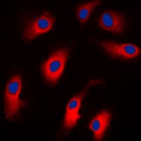 KRT18 / CK18 / Cytokeratin 18 Antibody (N-Terminus)