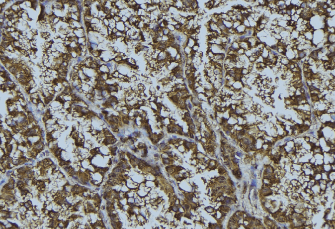 CRFR1 / CRHR1 Antibody