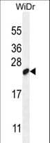 Polyclonal Rabbit anti-Human C19orf84 / LOC147646 Antibody (aa147-176, WB)