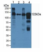 CP / Ceruloplasmin Antibody