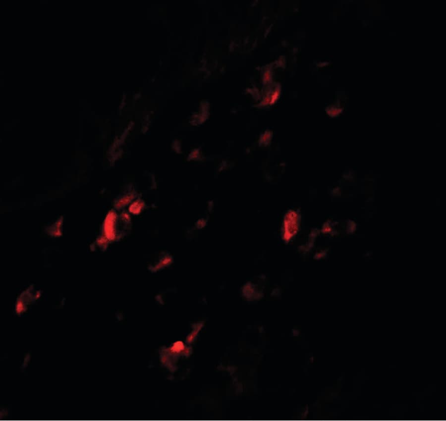 GPR44 / CRTH2 Antibody