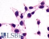 PathPlus™ Polyclonal Rabbit anti-Human GPR182 / ADMR Antibody (N-Terminus, IHC, WB)