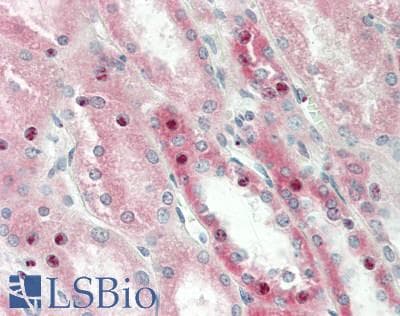IHC-plus™ Polyclonal Rabbit anti-Human ALK-6 / BMPR1B Antibody (IHC, IF, WB)