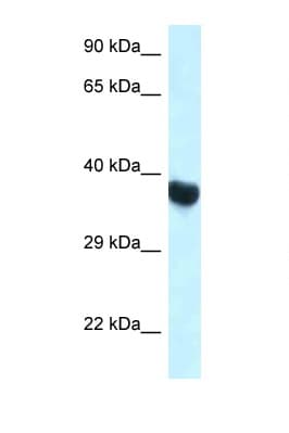 Polyclonal Rabbit anti-Rat HOXA10 Antibody (C-Terminus, WB)