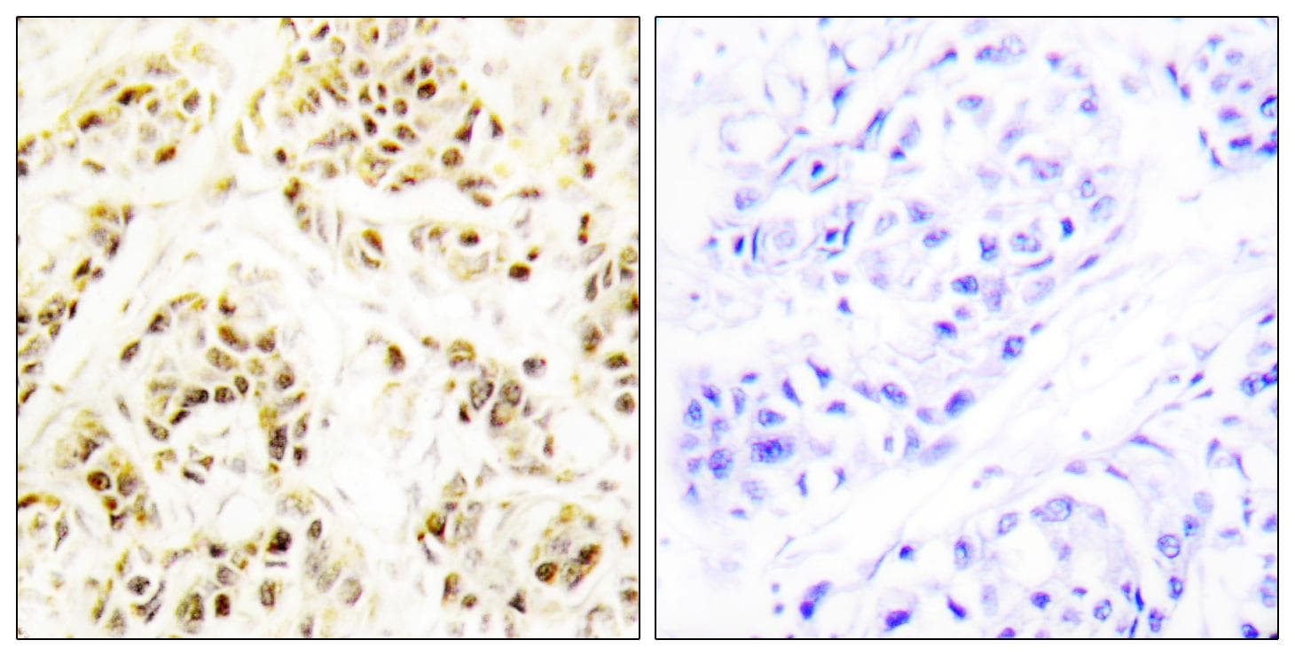 FEN1 Antibody