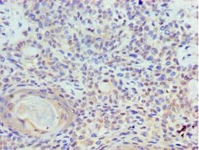 Polyclonal Rabbit anti-Human TOPBP1 Antibody (aa1253-1522, IHC)
