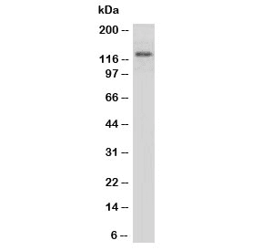MPO / Myeloperoxidase Antibody (aa714-728)