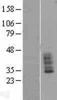 SLC14A1 / JK Protein (Over-Expression Lysate Myc-DDK (Flag))