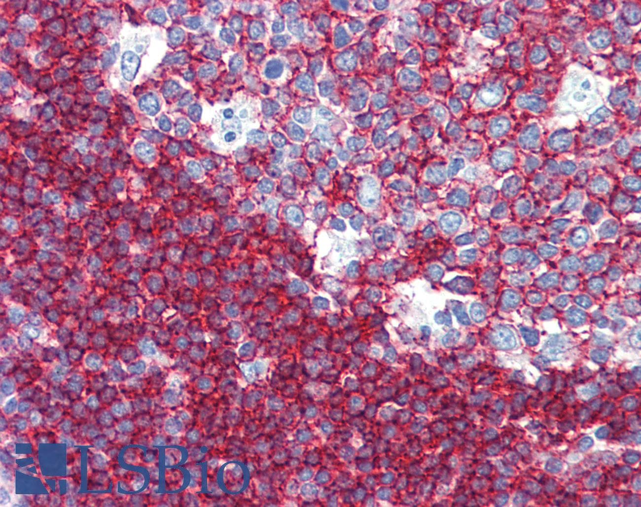 IHC-plus™ Monoclonal Mouse anti-Human CD37 Antibody (clone 2B8, IHC, IF)