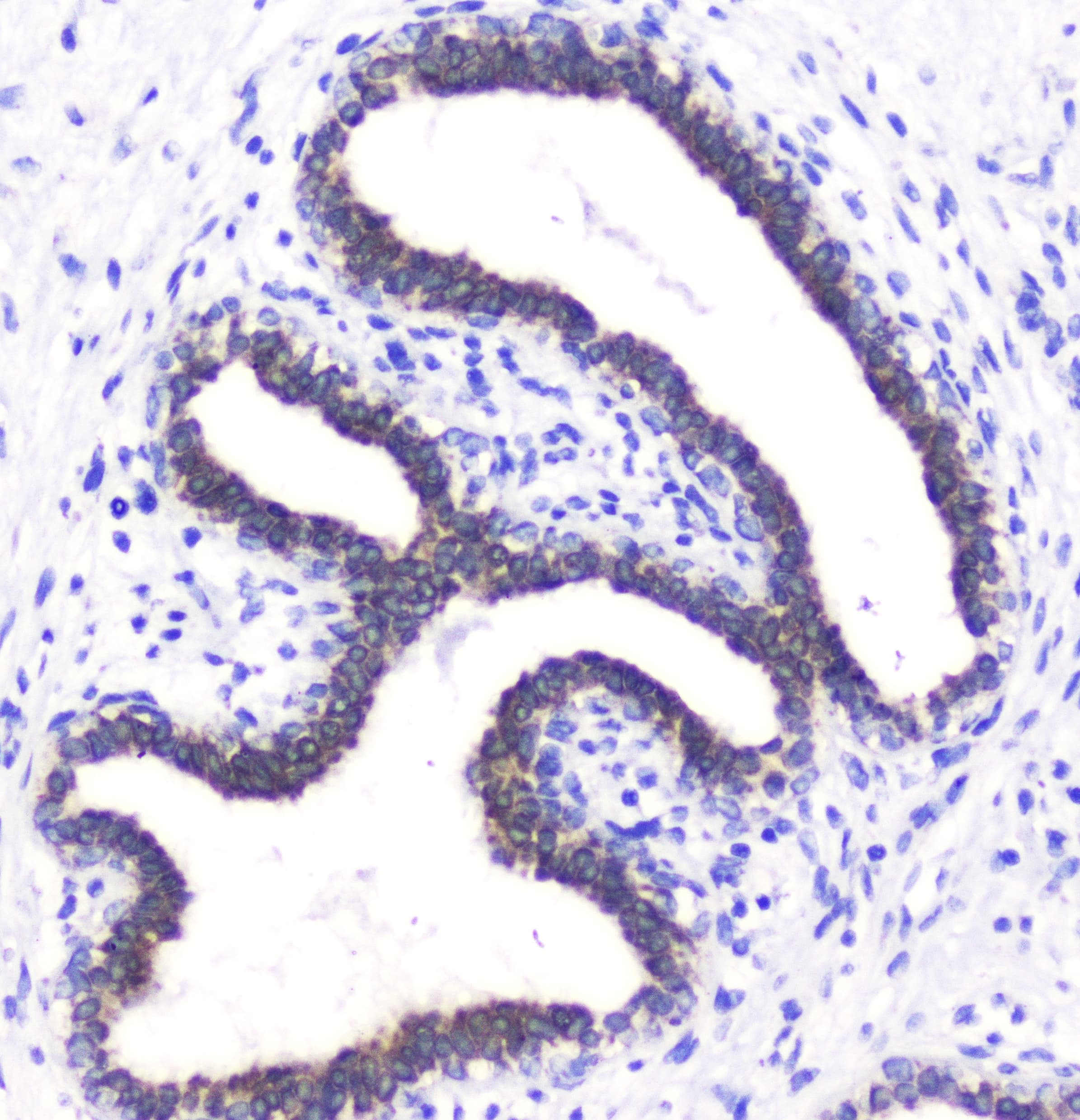 Polyclonal Rabbit anti-Human BTC / Betacellulin Antibody (IHC, WB)