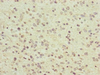 Polyclonal Rabbit anti-Human PCDHA12 Antibody (IHC)