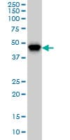 IHC-plus™ PIP4K2A / PIPK Antibody (clone 3A3)