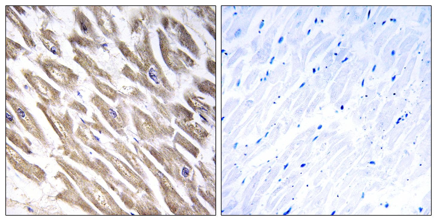 F13B / TGase Antibody