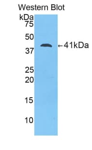 LCN12 Antibody (aa61-184)