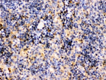 Polyclonal Rabbit anti-Human TRIB2 Antibody (IHC, WB)