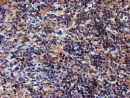 IDS / Iduronate 2 Sulfatase Antibody (clone OTI1D9)