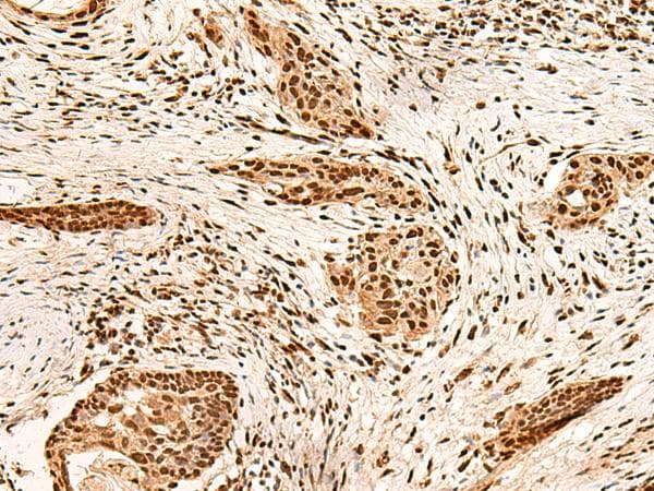 Polyclonal Rabbit anti-Human PAFAH1B2 Antibody (IHC)